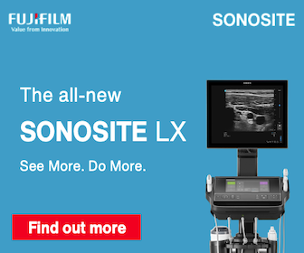 Sonosite